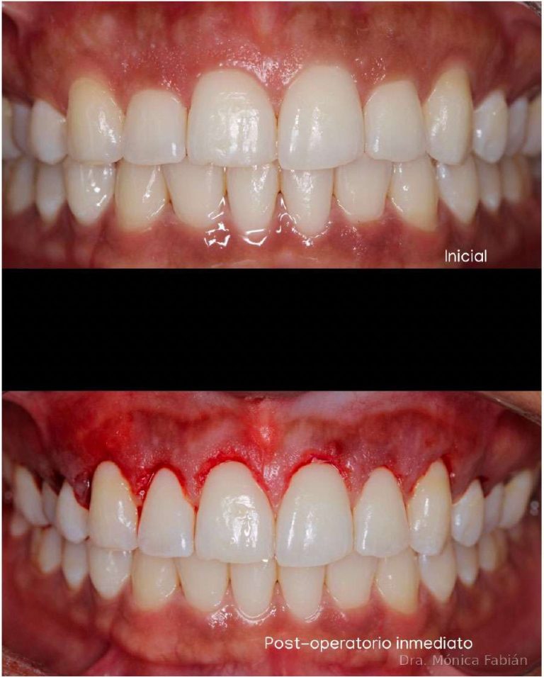 After — restored proportions